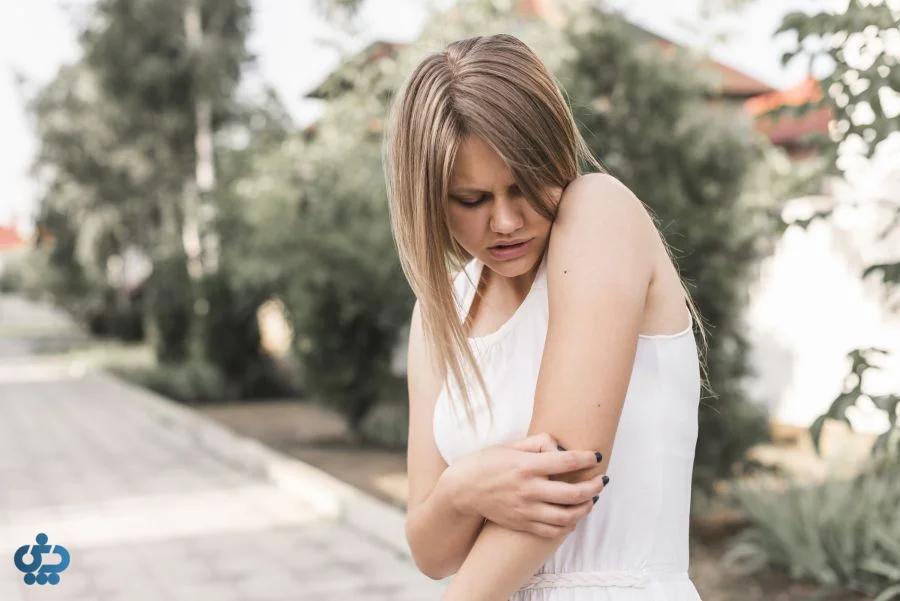 نیش زدن پشه